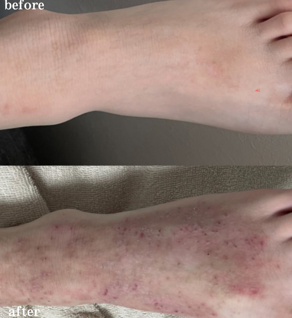 ボディの肌トラブルの改善