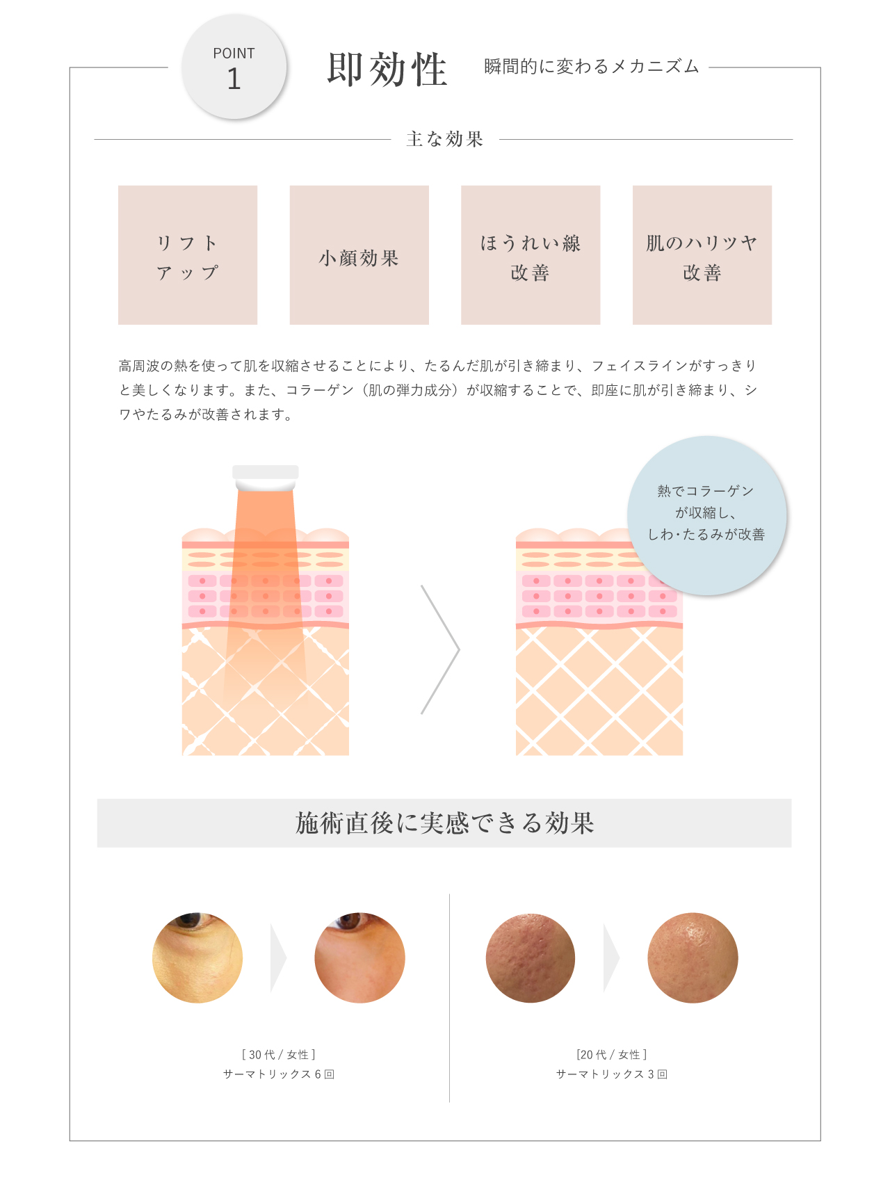 サーマトリックス ポイント1