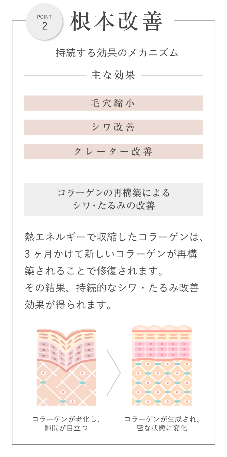 サーマトリックス ポイント2