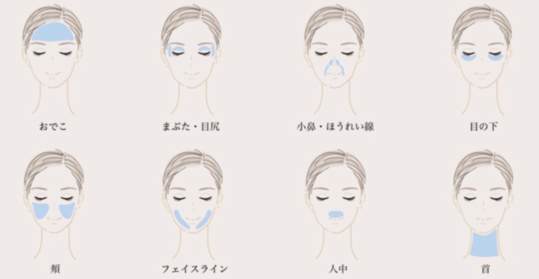 サーマトリックス施術部位